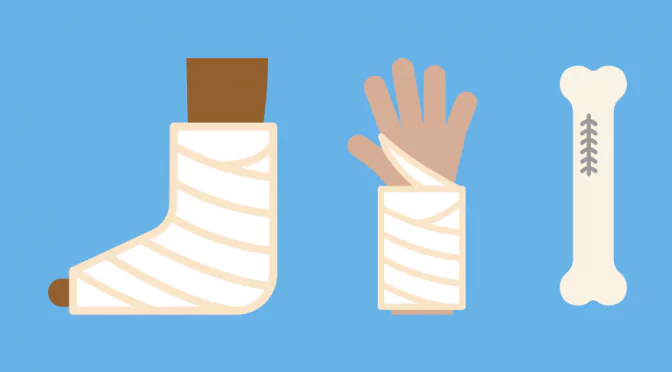 When is an incident reportable to RIDDOR